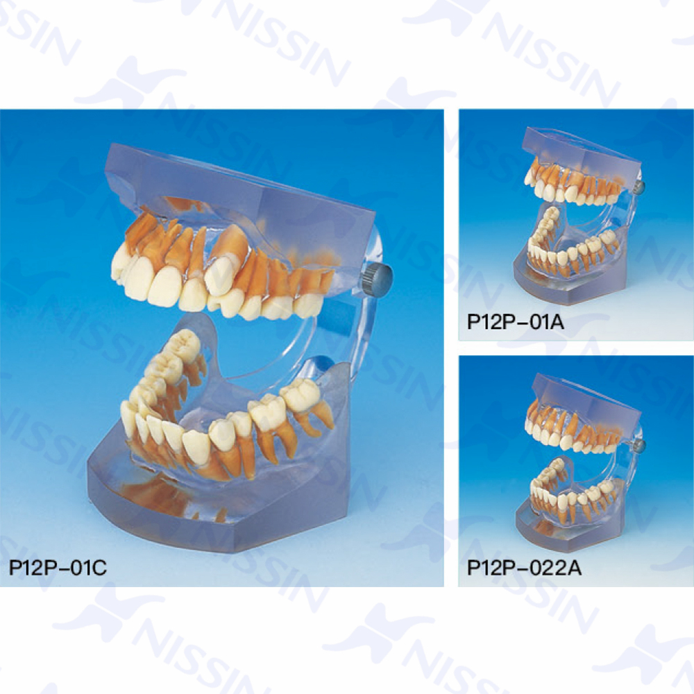 正畸錯(cuò)頜畸形分類演示模型（10組1套）